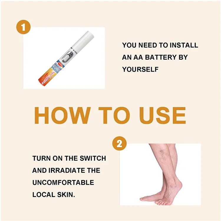 blue light pen solve varicose veins, hot sale leg care tools